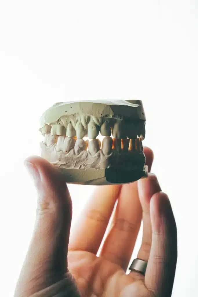 A hand holding a stone dental study model that displays a full set of upper and lower teeth in occlusion
