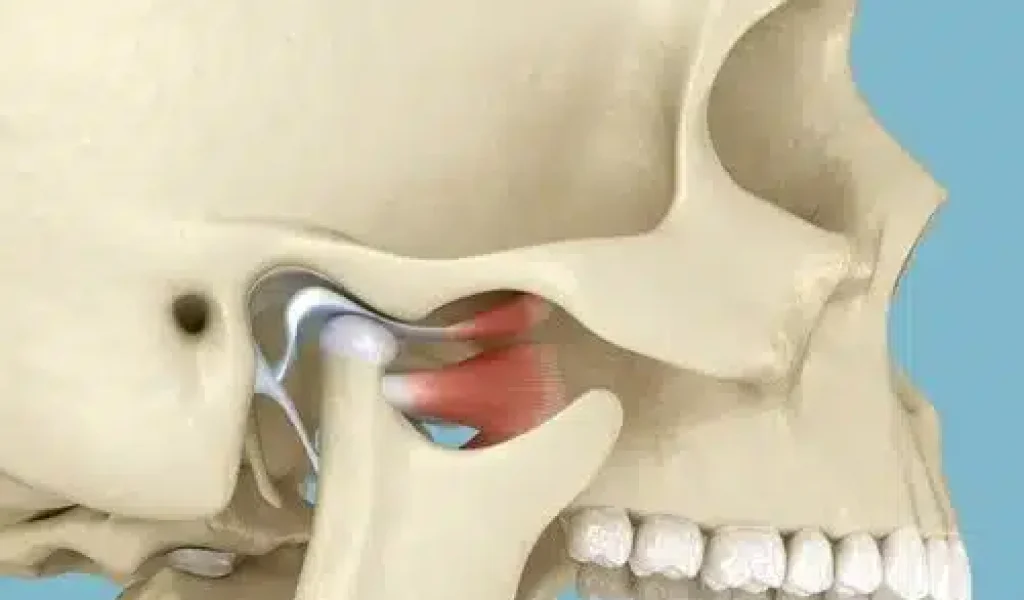 3D anatomical rendering of the temporomandibular joint (TMJ) and its surrounding internal structures