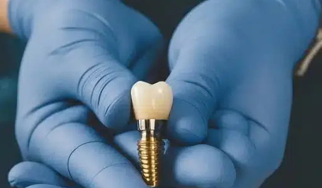 A complete dental implant model held in cupped, gloved hands