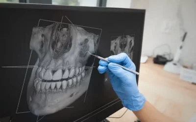 jaw-surgery
