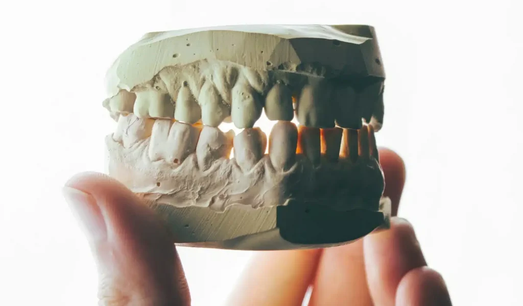 A hand holding a stone dental study model that displays a full set of upper and lower teeth in occlusion
